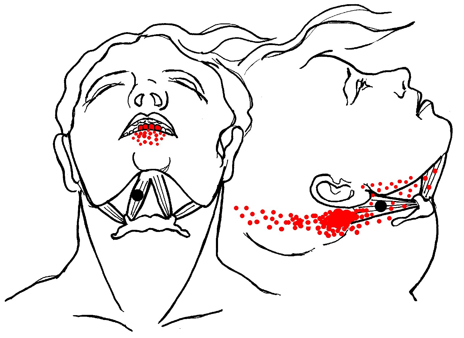 Digastric-pain